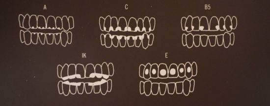 denti-maya-verona
